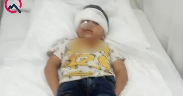 Qəzada yaralanan 6 yaşlı Kənanı kim müalicə etdirməlidir? Fotolar