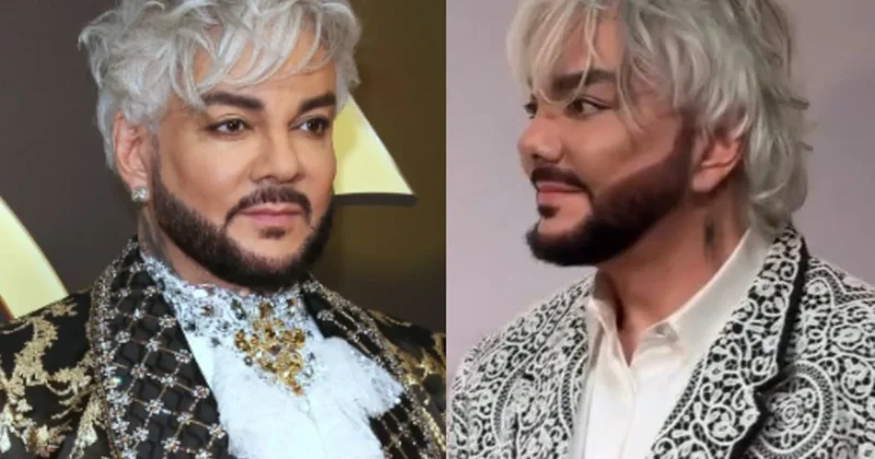 Kirkorov plastik əməliyyat etdirib? Foto