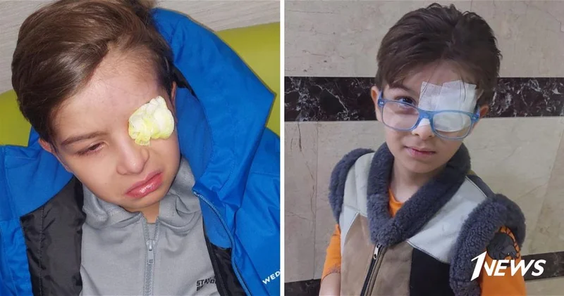 Опухоль в легком и угроза сердцу: маленькому Мирисмаилу, потерявшему глаз из за саркомы, нужна срочная операция ФОТО