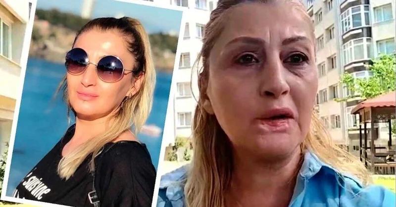 Dolğudan sonra dodağı çürüdü: “Nə gülə bilirəm, nə də rahat yemək yeyə