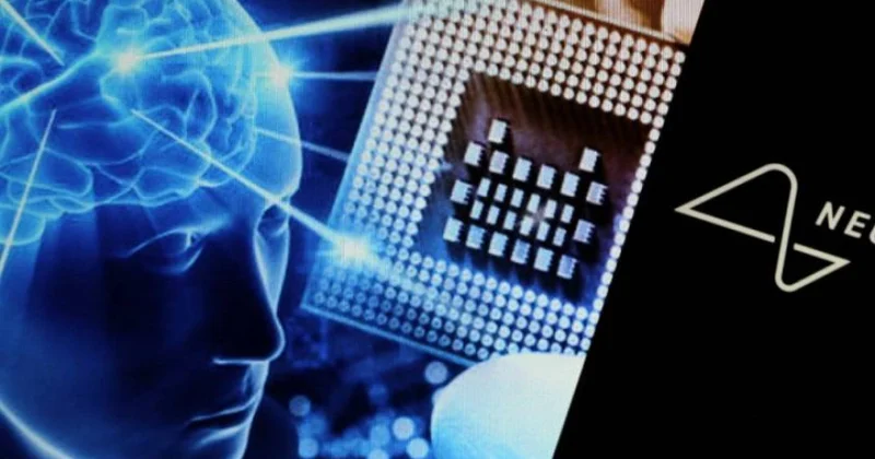 “Neuralink” 2026 cı ildə gözdən əlillərin görmə qabiliyyətini qismən bərpa edəcək