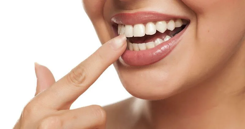 Diş həkiminə nə qədər tez tez getməlisiniz?