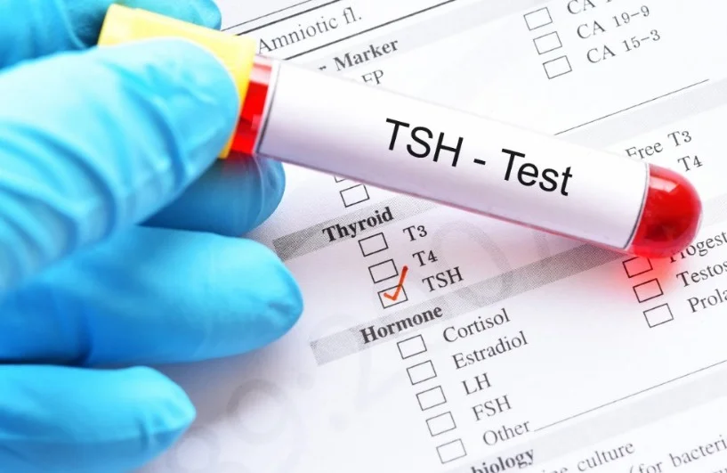 TSH (Tiroid Stimulating Hormon) Testi TSH nədir?