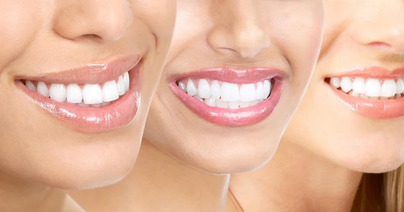 Найден способ восстановить зубную эмаль естественным путем