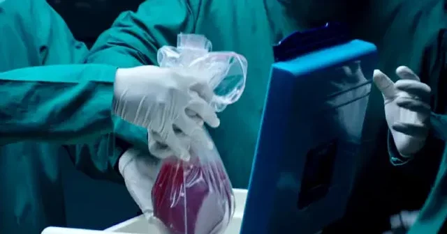 Azərbaycanda ən çox hansı orqanın köçürülməsinə ehtiyac var? AÇIQLAMA