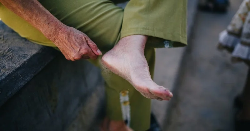 50, 60 və ya 70 yaşlada yaranan xərçəng ayaqlarda görünür