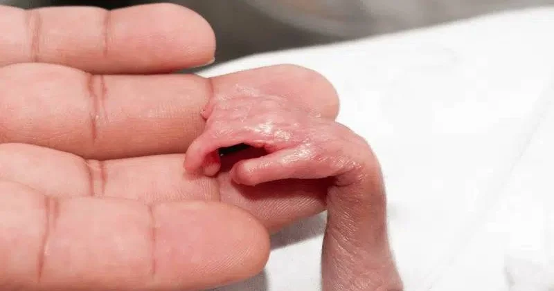 Xəstəxana həyətində 6 aylıq ölü dölün tapılması ilə bağlı TƏBİB dən AÇIQLAMA