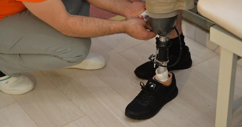 Vətən müharibəsindən sonra 500 ə yaxın şəxs yüksək texnologiyalı protezlə təmin edilib