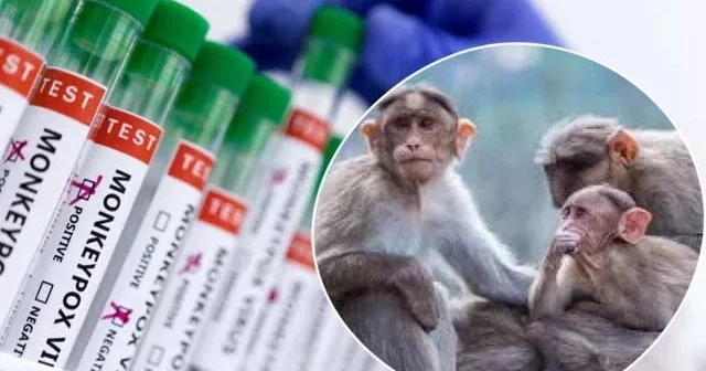 В Израиле зарегистрирован первый случай заражения агрессивным штаммом оспы обезьян