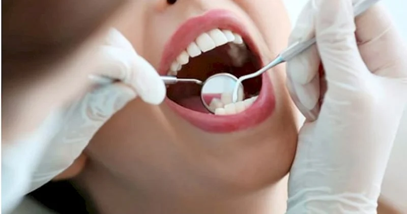 74 diş həkiminin qanunsuz fəaliyyəti aşkarlanıb Rəsmi