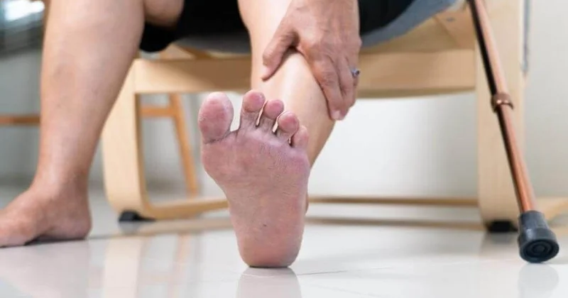 Diabetik ayaq sindromu: Amputasiyasız müalicə mümkündürmü? İnteqrativ tibb yanaşması VİDEO