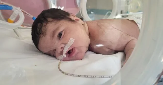 Türkiyədə yeni doğulmuş uşağın boynundan 445 qram şiş ÇIXARILDI