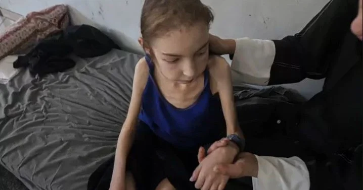 Qəzzada blokada uşaqları aclığa məhkum edir
