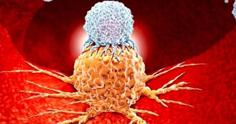 Alimlər xərçəngin müalicəsində yeni innovativ yanaşmanı araşdırıblar
