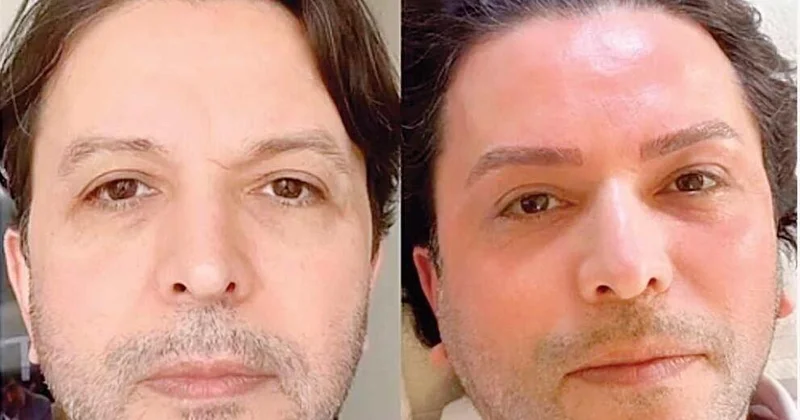 Estetik etdirib özünü tanınmaz hala saldı FOTO