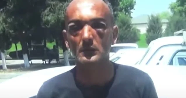 Toya gedən şəxs döyüləndən 9 gün sonra ölüb VİDEO KONKRET