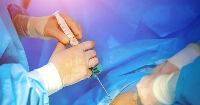 Azərbaycanda 500 dən çox xəstə sümük iliyi transplantasiyası gözləyir