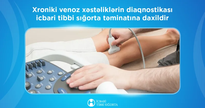 Xroniki venoz xəstəliklərinin diaqnostikası icbari tibbi sığorta təminatına daxildir