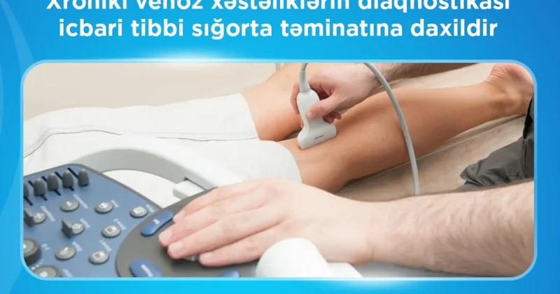 İTSDA: Xroniki venoz xəstəliklərin diaqnostikası icbari tibbi sığorta təminatına daxildir