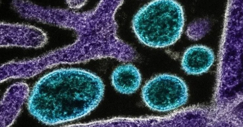 Çində Çikungunya virusu xəbərdarlığı: Ağcaqanadlar vasitəsilə yayılan epidemiya artır