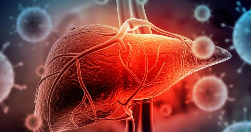 ÜST: Dünyada viral hepatitdən hər gün təqribən 3,5 min nəfər ölür