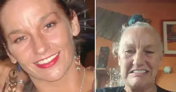 Cavanlaşmaq üçün bütün pulunu yeni dişlərə xərcləyən qadın indi 20 yaş qoca görünür