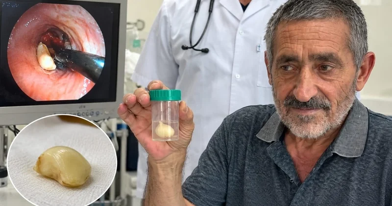 6 ay ağciyərində bu bitki ilə yaşadı həqiqət xəstəxanada üzə çıxdı KONKRET