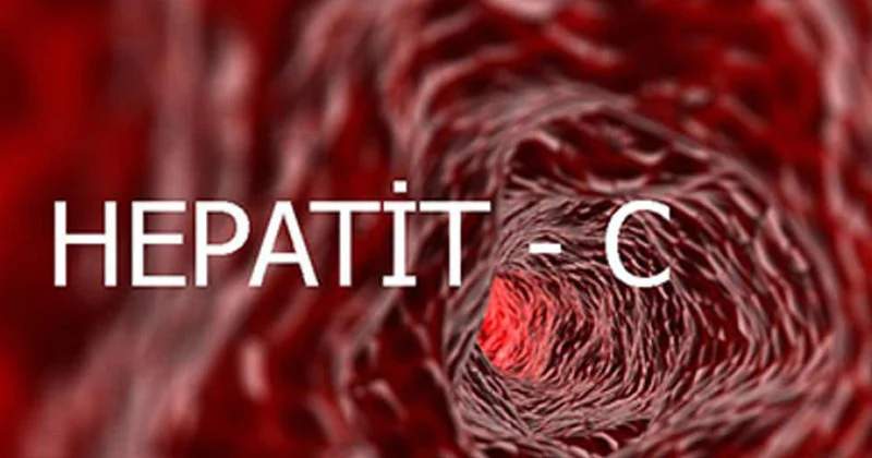 Rusiya hepatit C nin aşkarlanması üçün dünyada ilk sürətli test hazırlayıb