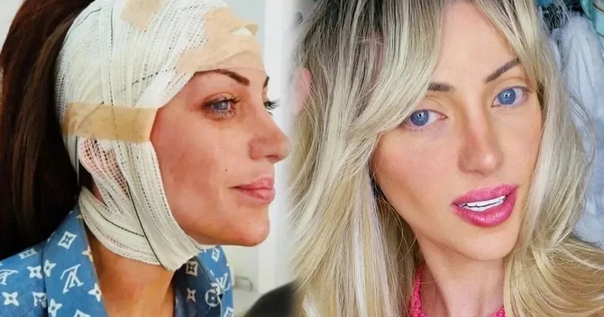 Canlı Barbie kimi tanınan influsr müəmmalı şəkildə ölü tapılıb