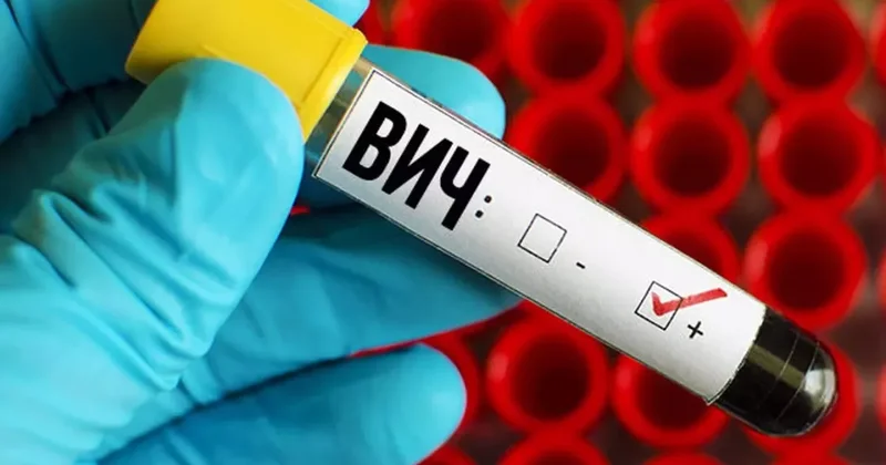 В России фиксируется рост заболеваемости ВИЧ инфекцией