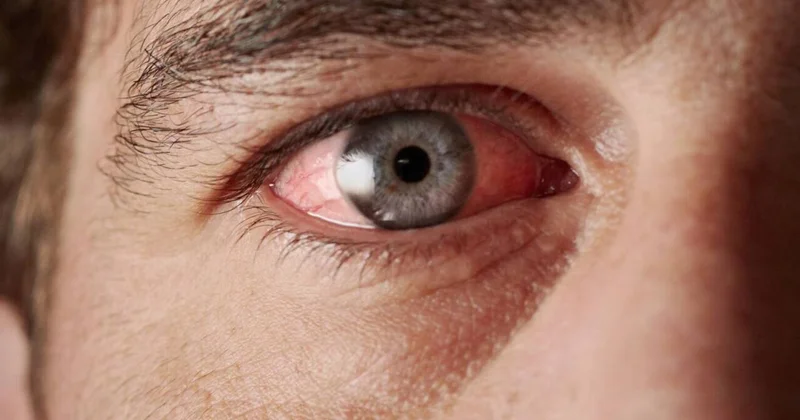 Gərginsinizsə bu vitamininiz çatışmır