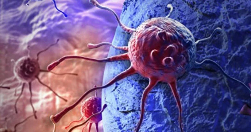 Gənclərdə artan müəmmalı xərçəngi araşdıran jurnalist 29 yaşında bu xəstəliyə tutuldu