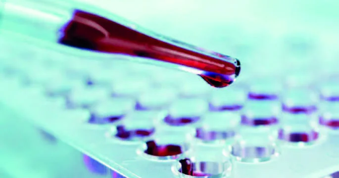 Xərçəngin diaqnozu asanlaşır