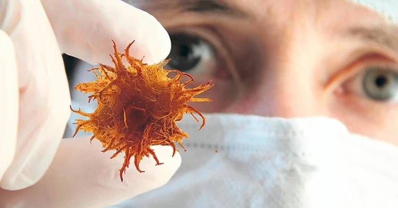 Xərçəngin müalicəsi ilə bağlı MÜHÜM AÇIQLAMA KONKRET