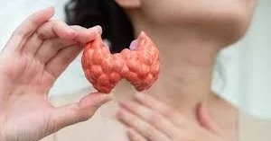 Dırnaqlarda qalxanvari vəz xəstəliyinin əlaməti