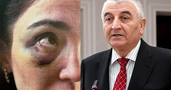 Keçmiş gəlinindən Məzahir Pənahova İTTİHAM: Ona nüfuz önəmli deyil, zinət əşyalarımı qaytarmırlar