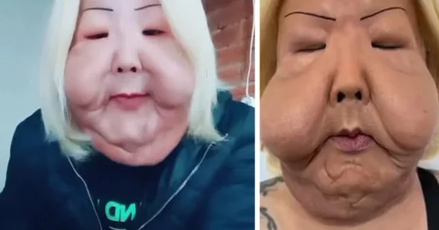 Gözəl olmaq istədi, tanınmaz hala düşdü ŞOK FOTOLAR