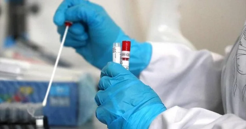 Sonsuzluq yaradan gizli virus Hər yerdə yoluxa bilərsiniz