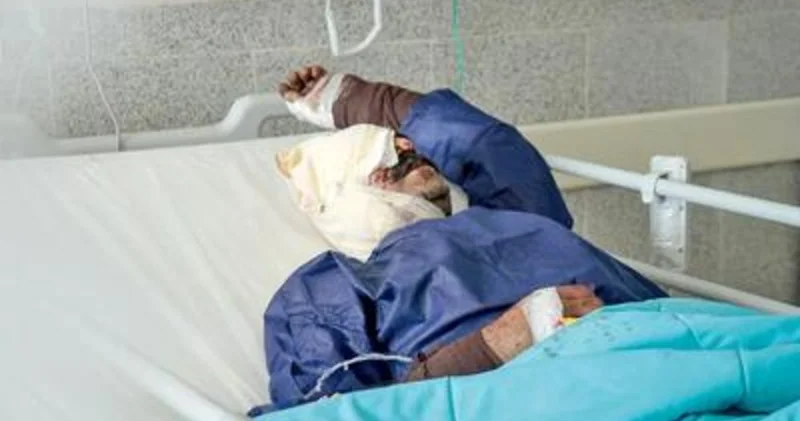 Bəndər Abbasdakı partlayışdan sonra onlarla insan görmə qabiliyyətini itirib