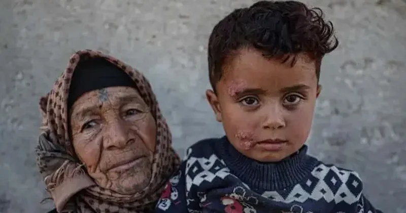 Suriyada qorxunc xəstəlik yayılır: Artıq 1500 nəfər yoluxub (FOTO)