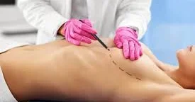 Süd vəzi amputasiyası xərçəngdən xilas etmir