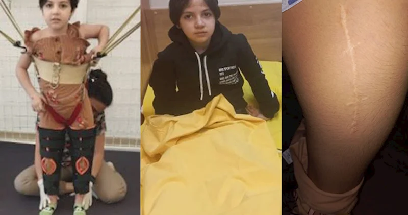 10 yaşlı Aytən dördüncü dəfə əməliyyat olunacaq, köməyə ehtiyacı var Fotolar