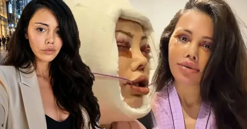 Didem Ceran 15 saatlıq estetik əməliyyat keçirmişdi Özünü ünlü ilə müqayisə etdi