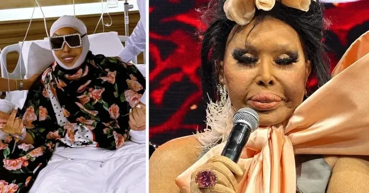 “Mənə bacı deməyin” Bülent Ersoydan estetik əməliyyat açıqlaması