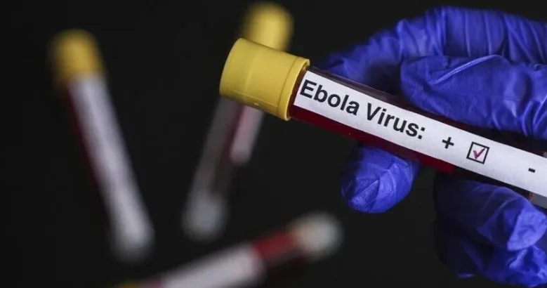Konqoda Ebola epidemiyası 3 095 nəfərin həyatına son qoyub