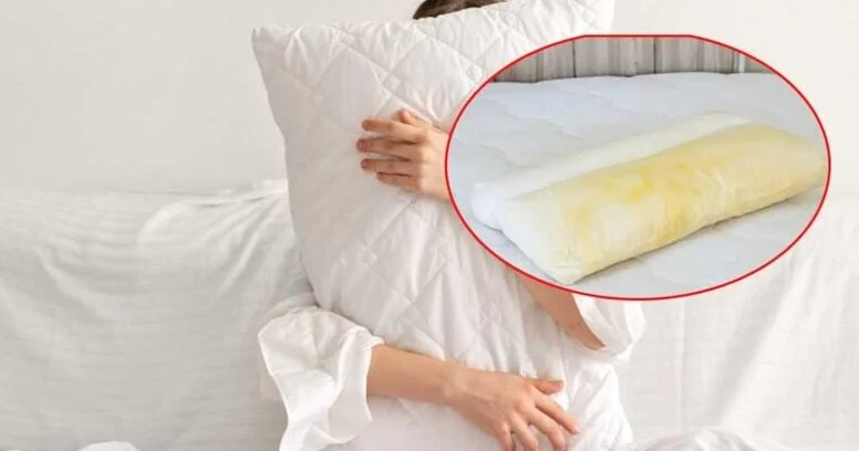 Soda və sirkə ilə yastıqdakı sarı ləkəni ağappaq edin