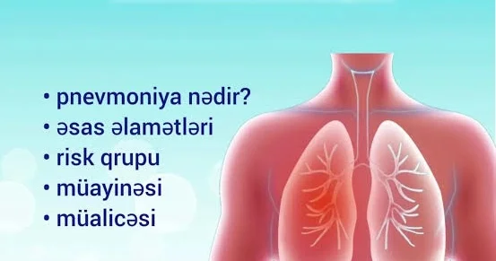 Pnevmoniyanın əsas əlamətləri nələrdir? HƏKİM DANIŞDI