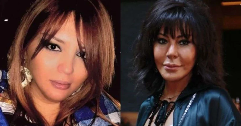 "Həyatda hər şeyə olar" Dadaşovanın qabırğasını sındıran əri danışdı