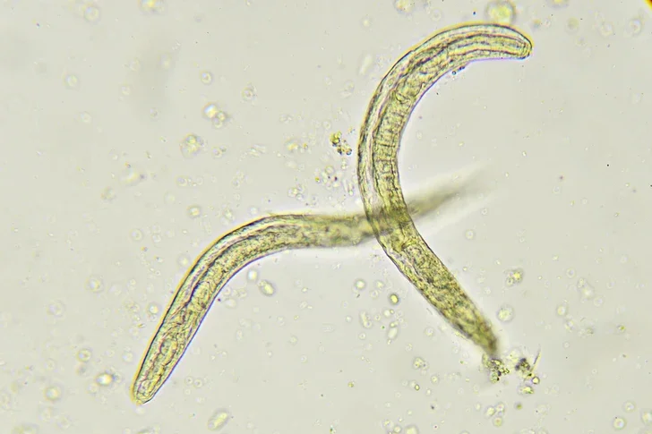 Ученые выяснили, как африканские глисты проникли в Европу 500 лет назад Новости Азербайджана