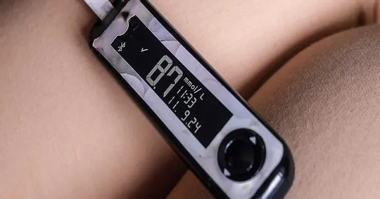 Diabet və dişlər arasında nə əlaqə var? Alimlər açıqladı